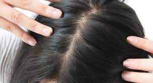 Saçlarda görülen kırılma ve saç derisi kaşıntısının nedeni BİOTİN, ÇİNKO, DEMİR VE E vitamini Eksliğinden